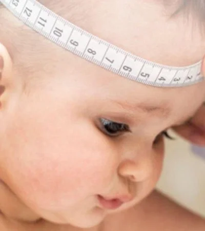 img-destacada-infantil-hidrocefalia-960x750-jpg.