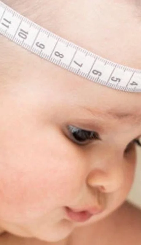 img-destacada-infantil-hidrocefalia-960x750-jpg.