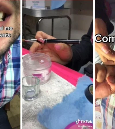 diente-roto-tik-tok-png.