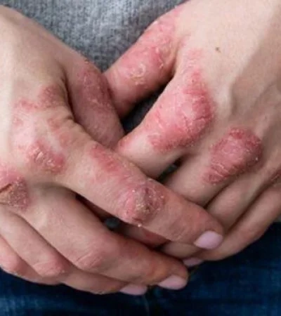 c4649d148295c99749aed8eef1b072f8-jpeg.