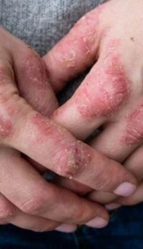 c4649d148295c99749aed8eef1b072f8-jpeg.