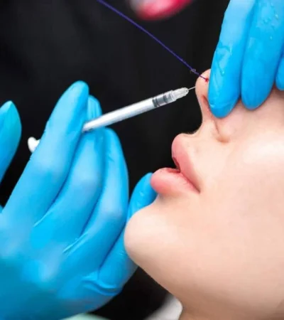 inyeccion-acido-hialuronico-jpg.