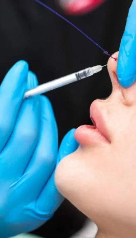 inyeccion-acido-hialuronico-jpg.