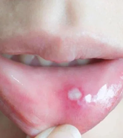 39d29c71-b53b-4f3e-a33e-8691cab85653-16-9-discover-aspect-ratio-default-0-jpg.