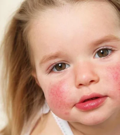 leti-productos-piel-atopica-e-jpg.