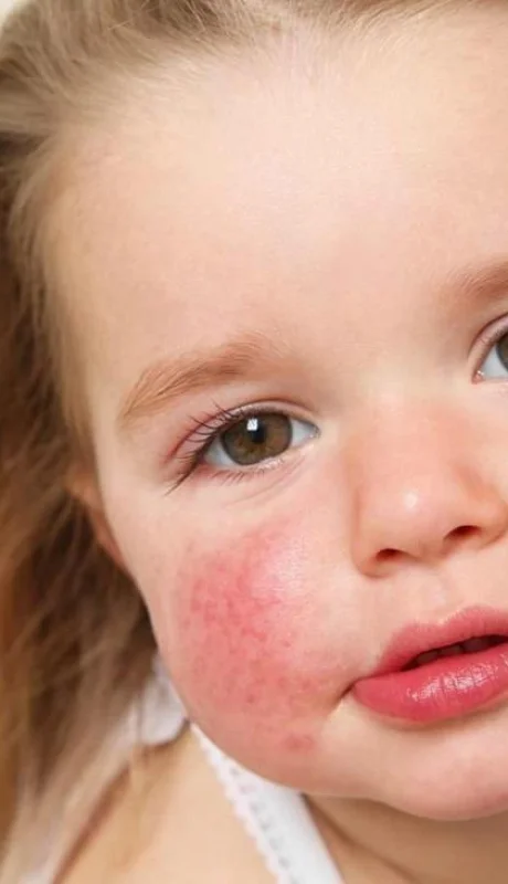 leti-productos-piel-atopica-e-jpg.