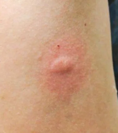 istockphoto-992955126-612x612-jpg.