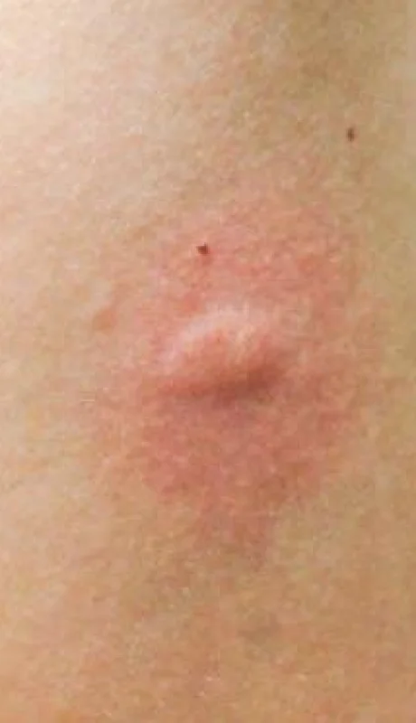 istockphoto-992955126-612x612-jpg.