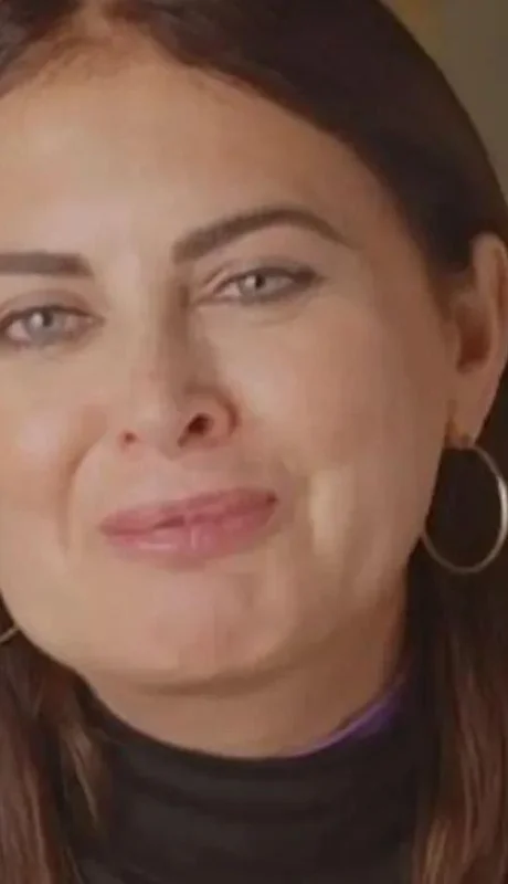 silvina-luna-cara-rostro-rinones-operacion-actualidad-jpg.