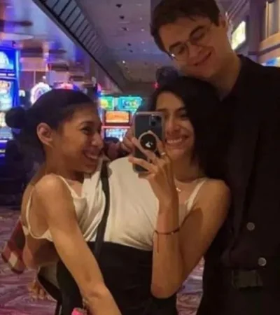 siamesas-famosas-novio-pareja-png.