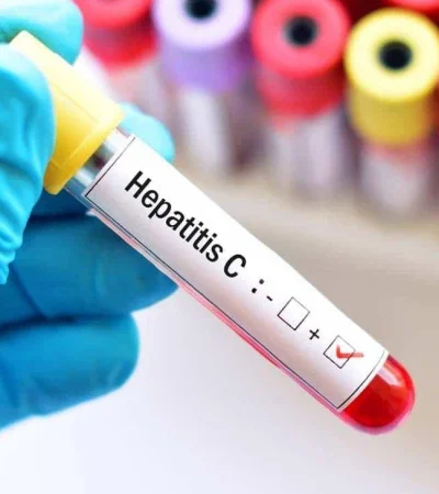 hepatitis-c-jpg.