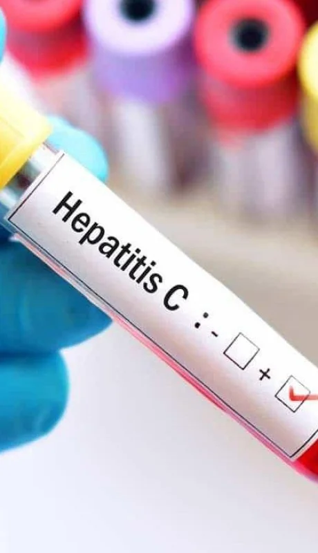 hepatitis-c-jpg.