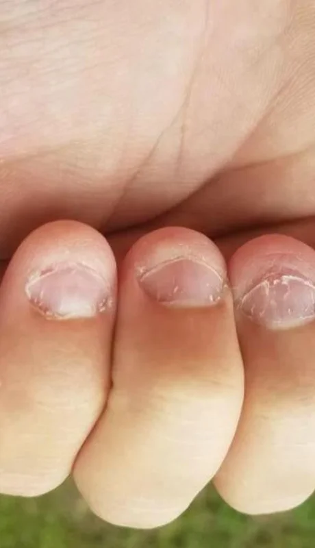 onicofagia-morderse-las-unas-jpg.