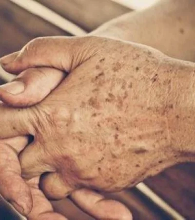 envejecimiento-khde--620x349-abc-jpg.