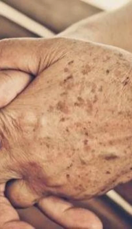 envejecimiento-khde--620x349-abc-jpg.