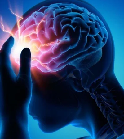 acv-conrado-estol-neurologia-salud-cerebro-png.