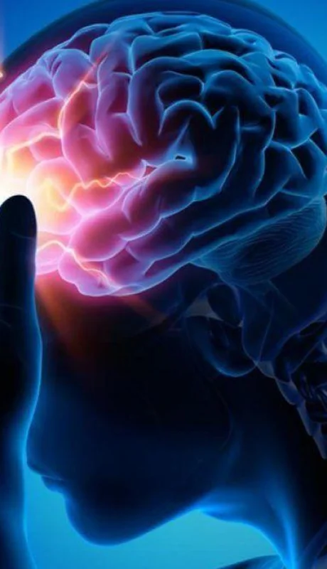 acv-conrado-estol-neurologia-salud-cerebro-png.