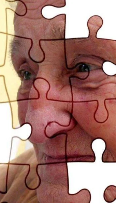 alzheimer-jpg.