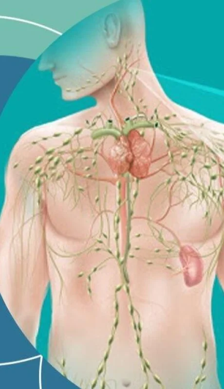 20-08-19-linfoma-1080x675-1-jpg.