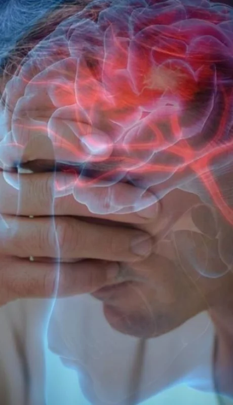 ACV: los 7 síntomas que pueden aparecer hasta un mes antes