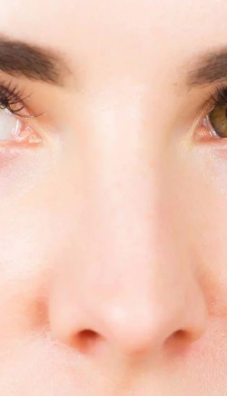 ambliopia-estrabica-menores-jovenes-jpg.