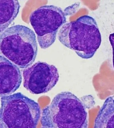 entrevistar-al-hematologo-miguel-castro-rios-quien-hablo-de-la-enfermedad-y-el-tratamiento-para-traer-luz-ante-tanta-oscuridad-y-miedo-que-hay-cuando-