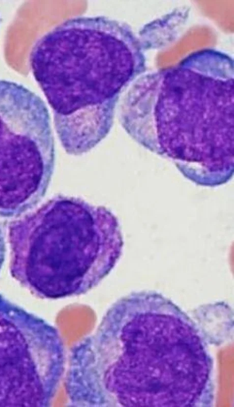 entrevistar-al-hematologo-miguel-castro-rios-quien-hablo-de-la-enfermedad-y-el-tratamiento-para-traer-luz-ante-tanta-oscuridad-y-miedo-que-hay-cuando-