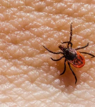 picadura-garrapata-mendoza-casos-png.