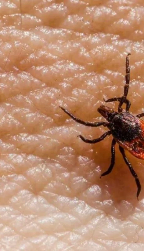 picadura-garrapata-mendoza-casos-png.