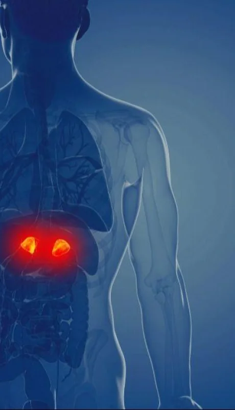 cushing-sindrome-png.