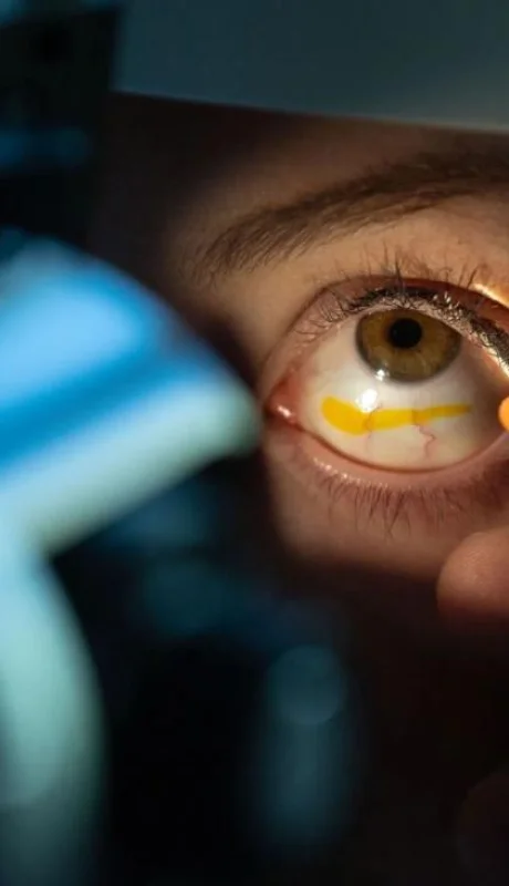 glaucoma-ojos-ceguera-png.