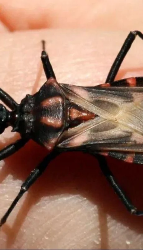 mal-de-chagas-enfermedad-argentina-png.