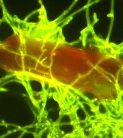 Plástico colonizado por hongos