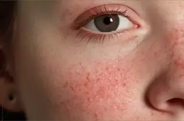 Un estudio clínico muestra ser prometedor contra una importante enfermedad