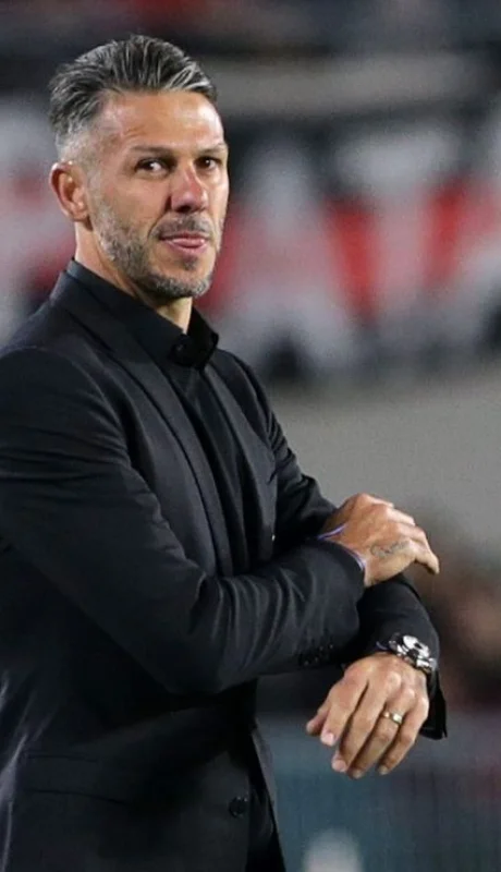 Dolor de cabeza para Micho