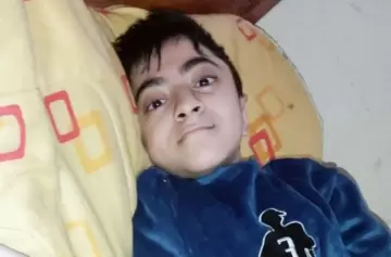 Un niño salteño superó una cirugía de columna de 10 horas en Buenos Aires