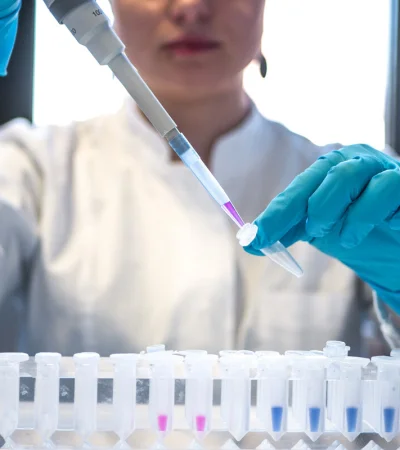 Avance en la lucha contra el sida.