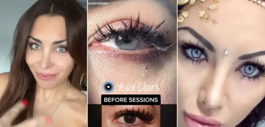 El cambio forzado de los colores de los ojos representa un grave riesgo para la salud humana según los expertos.