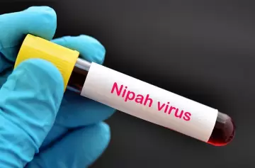 Adolescente muere por virus Nipah en India: ¿una nueva amenaza pandémica?