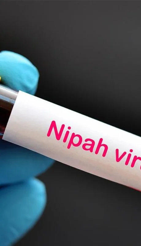 Adolescente muere por virus Nipah en India: ¿una nueva amenaza pandémica?