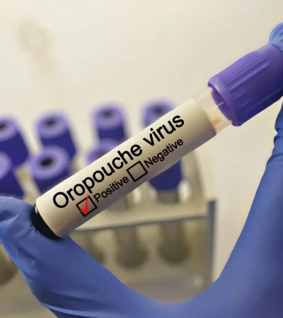 El virus que acecha a América Latina y enciende las alarmas en la Argentina