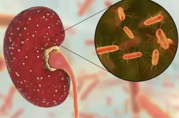 Síndrome urémico hemolítico en Argentina: por qué la prevención es clave