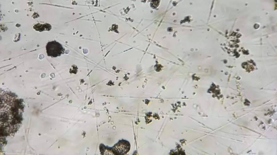 Los microplásticos ya ingresaron a varios órganos de nuestro cuerpo