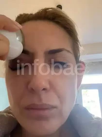 Yañez presentó en la justicia imágenes de las agresiones que denunció de parte de Fernández.