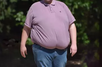 Obesidad en Estados Unidos: un problema que cuesta 173 mil millones de dólares