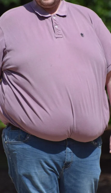 En 1960, el 13,4% de los adultos eran personas obesas, y el 0,9% padecía una obesidad severa.