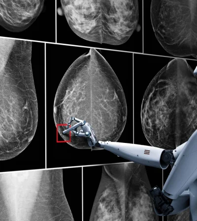 Se puede detectar el cáncer e infecciones virales con "precisión nanométrica"