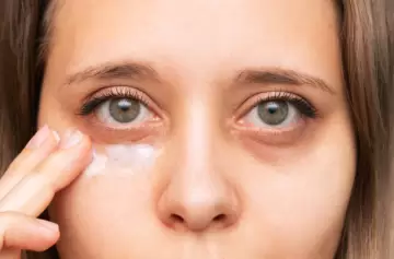 Este es el método para despedirte de las ojeras de manera eficaz y natural