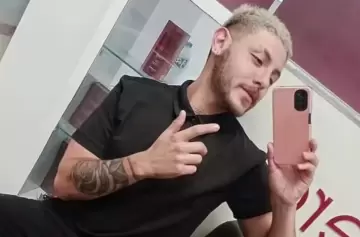 Falleció el argentino que estaba internado por viruela del mono en México