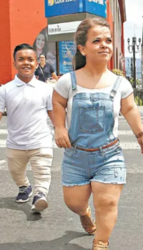 La acondroplasia es un trastorno genético que afecta el crecimiento óseo y se caracteriza por una estatura baja y extremidades cortas.